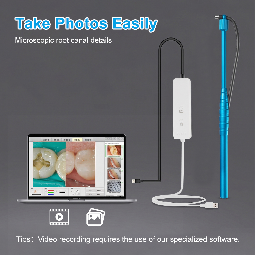 5MP Micro Intraoral Camera Den – обзор и цена Mini Pc Windows